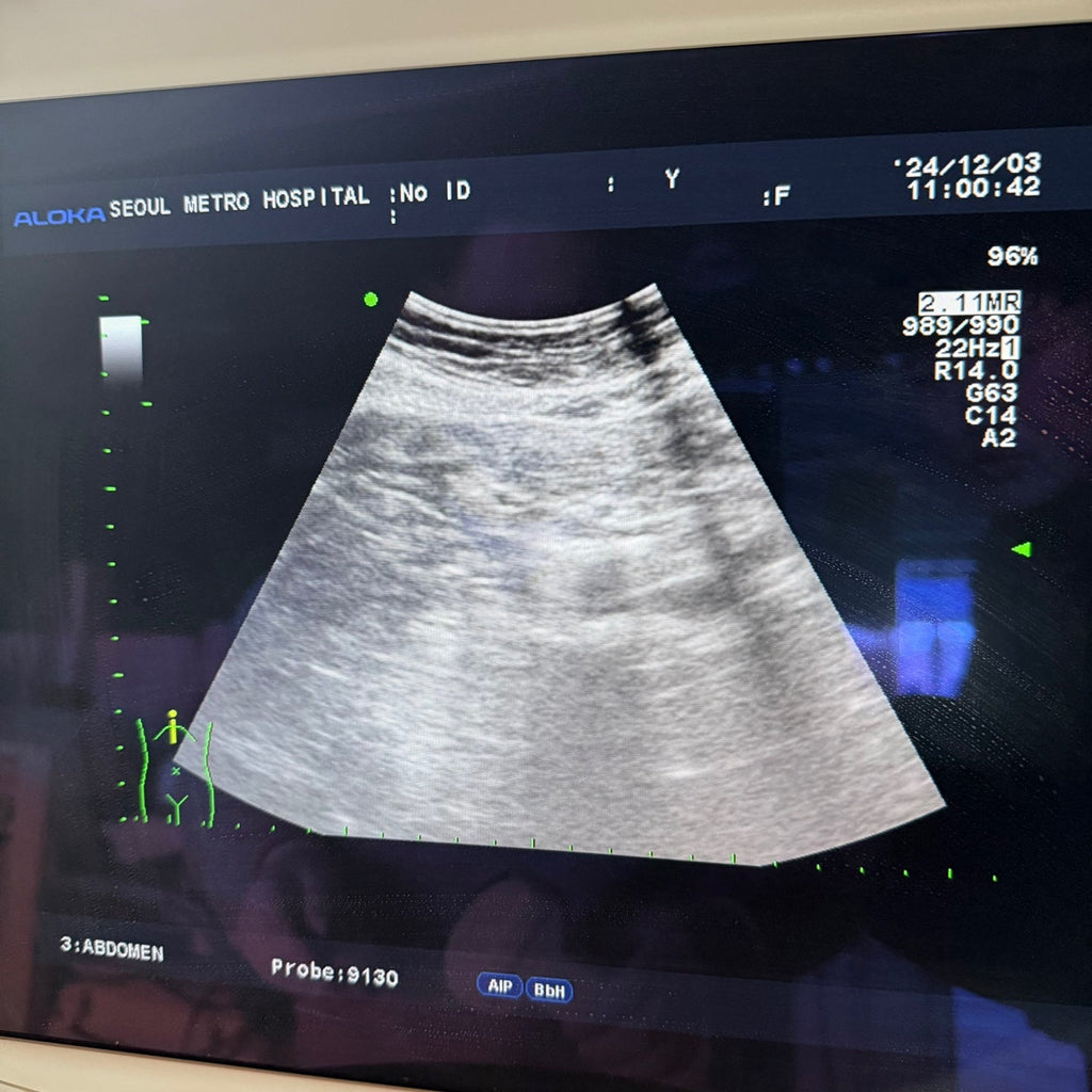 Aloka Prosound Alpha7 with Convex, Cardiac & Linear Probes