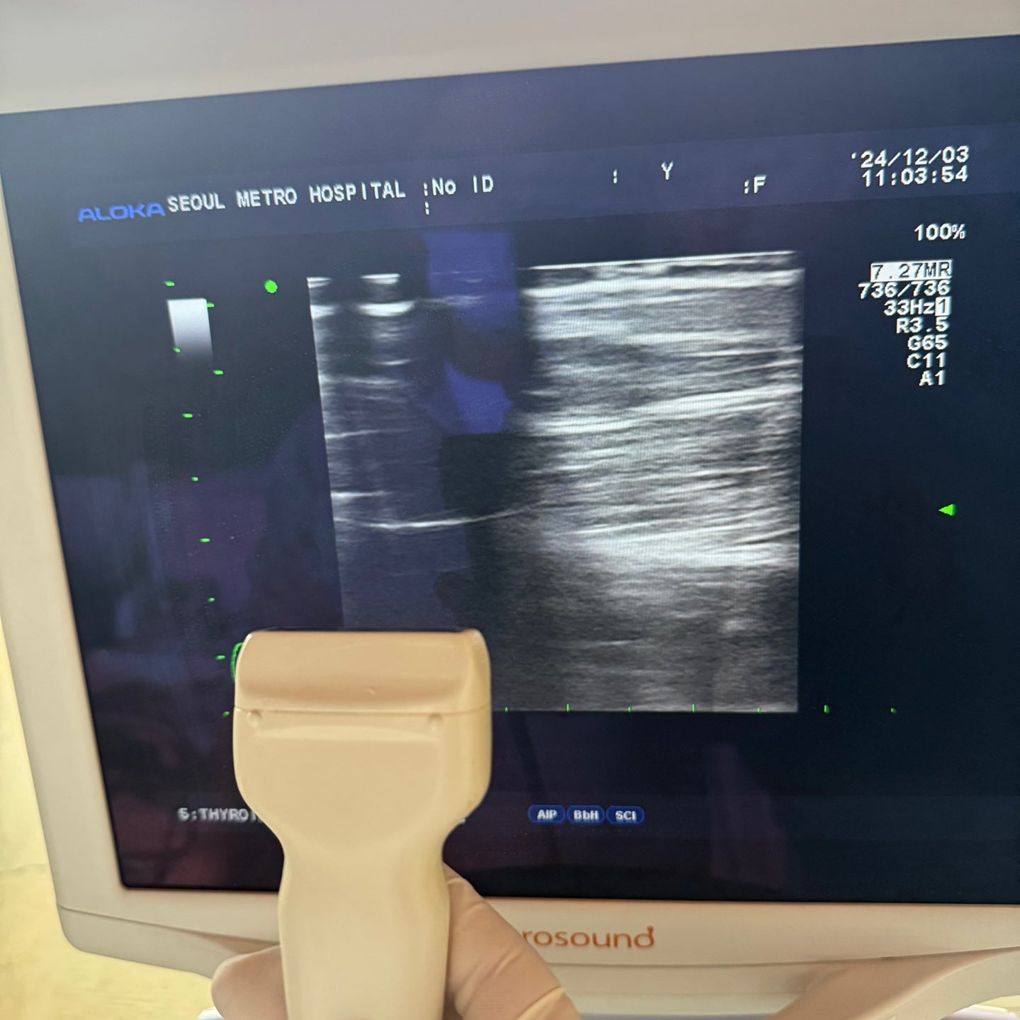 Aloka Prosound Alpha7 with Convex, Cardiac & Linear Probes