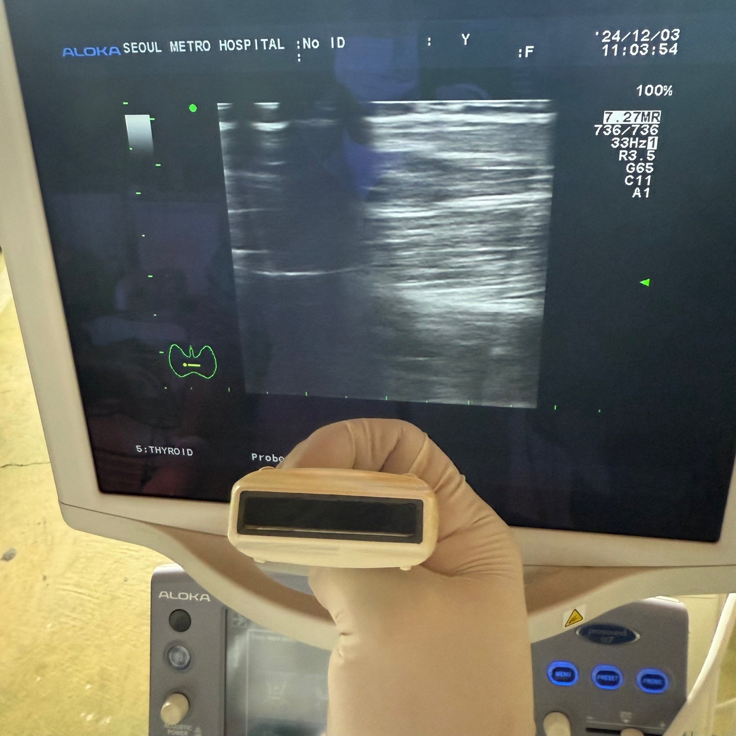Aloka Prosound Alpha7 with Convex, Cardiac & Linear Probes