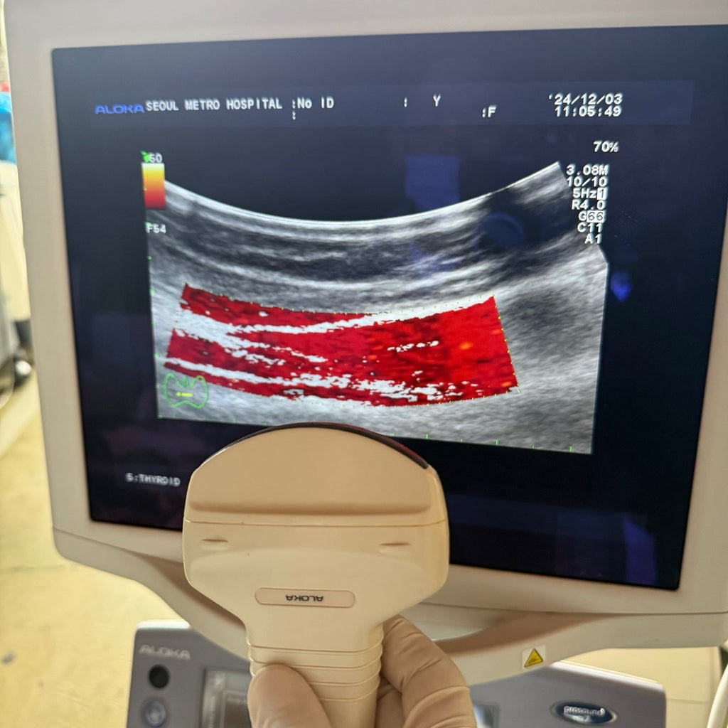 Aloka Prosound Alpha7 with Convex, Cardiac & Linear Probes