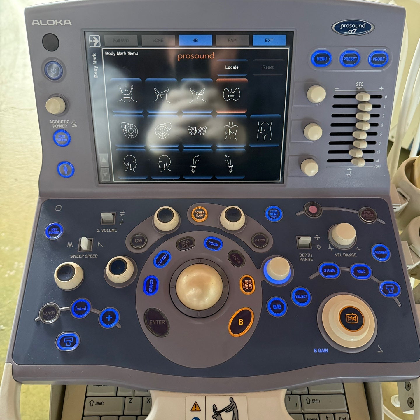 Aloka Prosound Alpha7 with Convex, Cardiac & Linear Probes