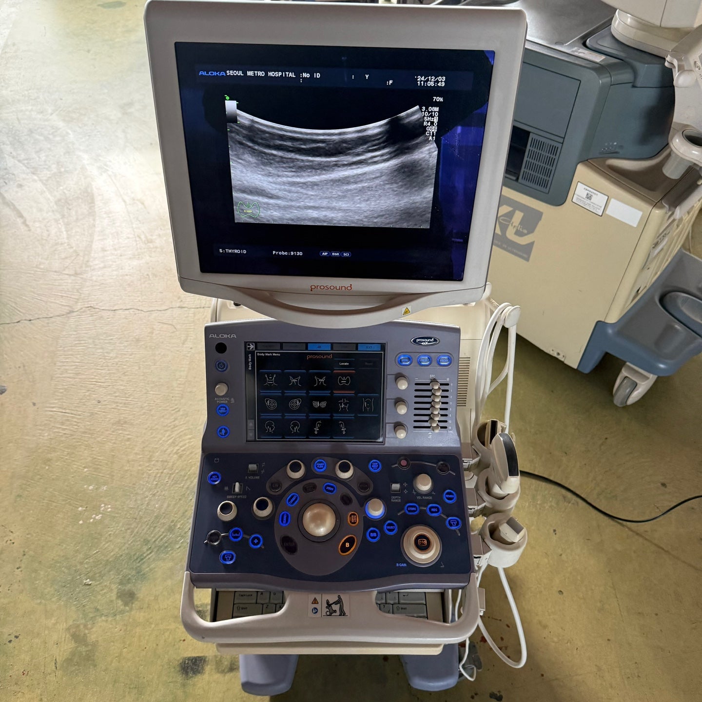 Aloka Prosound Alpha7 with Convex, Cardiac & Linear Probes