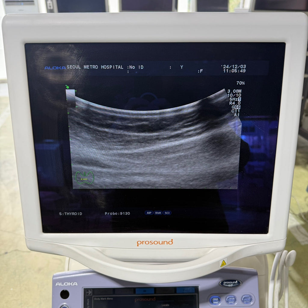 Aloka Prosound Alpha7 with Convex, Cardiac & Linear Probes