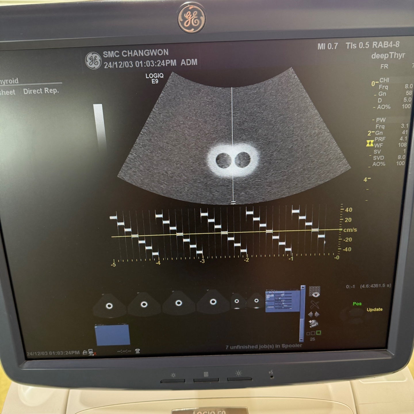 GE Logiq E9 with 3 Probes L8-18i & 9L & M4S