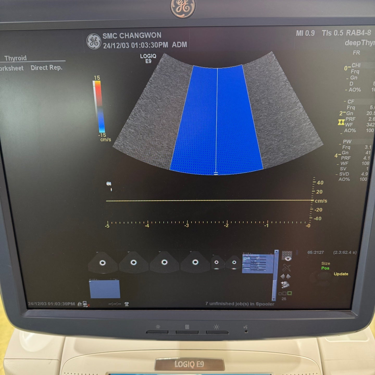 GE Logiq E9 with 3 Probes L8-18i & 9L & M4S