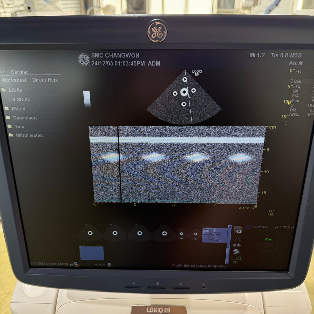 GE Logiq E9 with 3 Probes L8-18i & 9L & M4S
