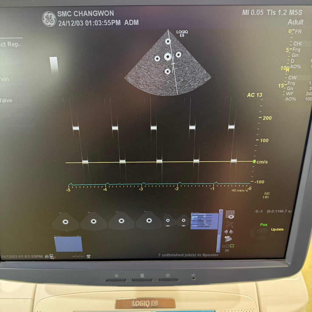 GE Logiq E9 with 3 Probes L8-18i & 9L & M4S