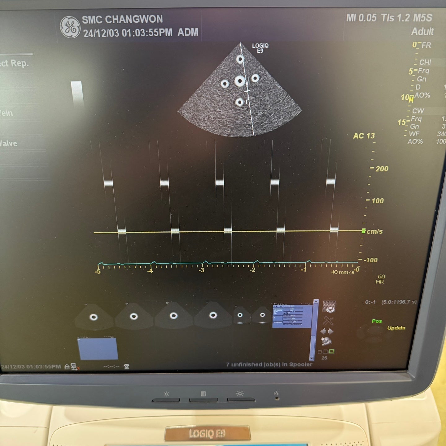 GE Logiq E9 with 3 Probes L8-18i & 9L & M4S