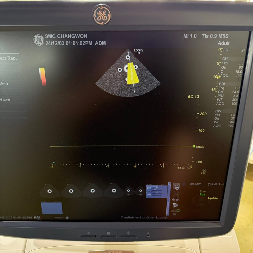 GE Logiq E9 with 3 Probes L8-18i & 9L & M4S