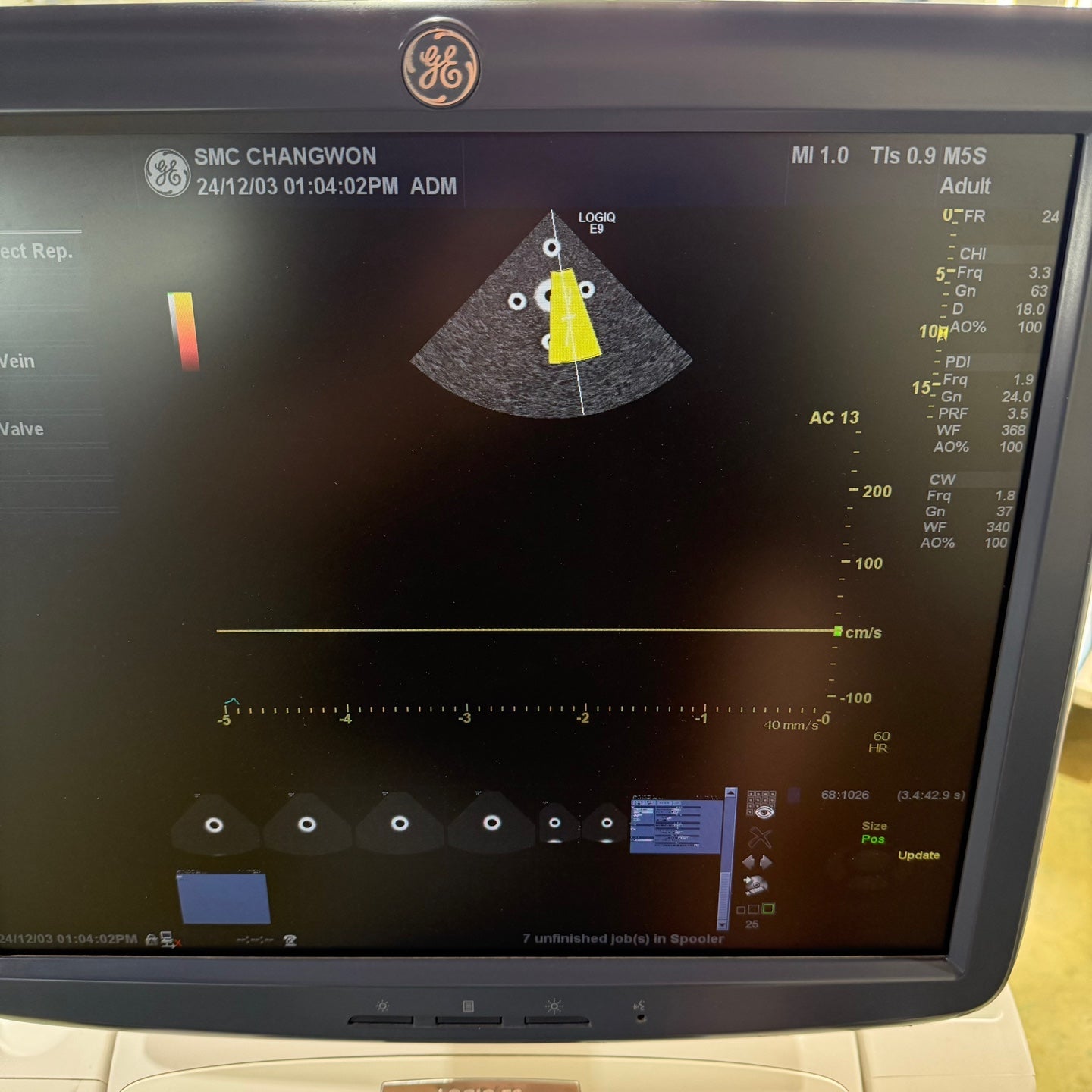 GE Logiq E9 with 3 Probes L8-18i & 9L & M4S