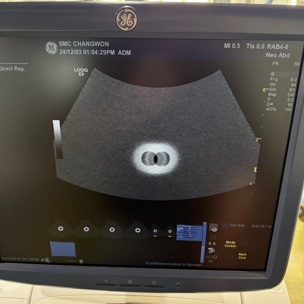 GE Logiq E9 with 3 Probes L8-18i & 9L & M4S
