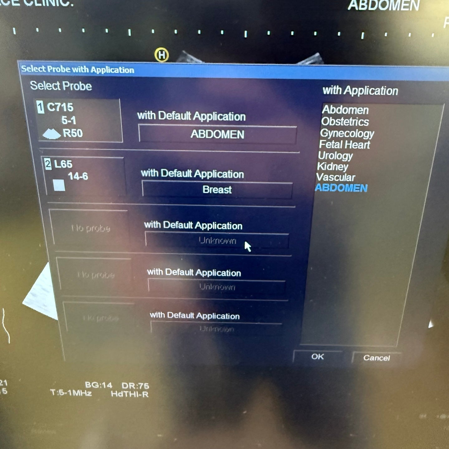 Pre-Owned HITACHI Avius HI VISION Ultrasound System With 2Probes