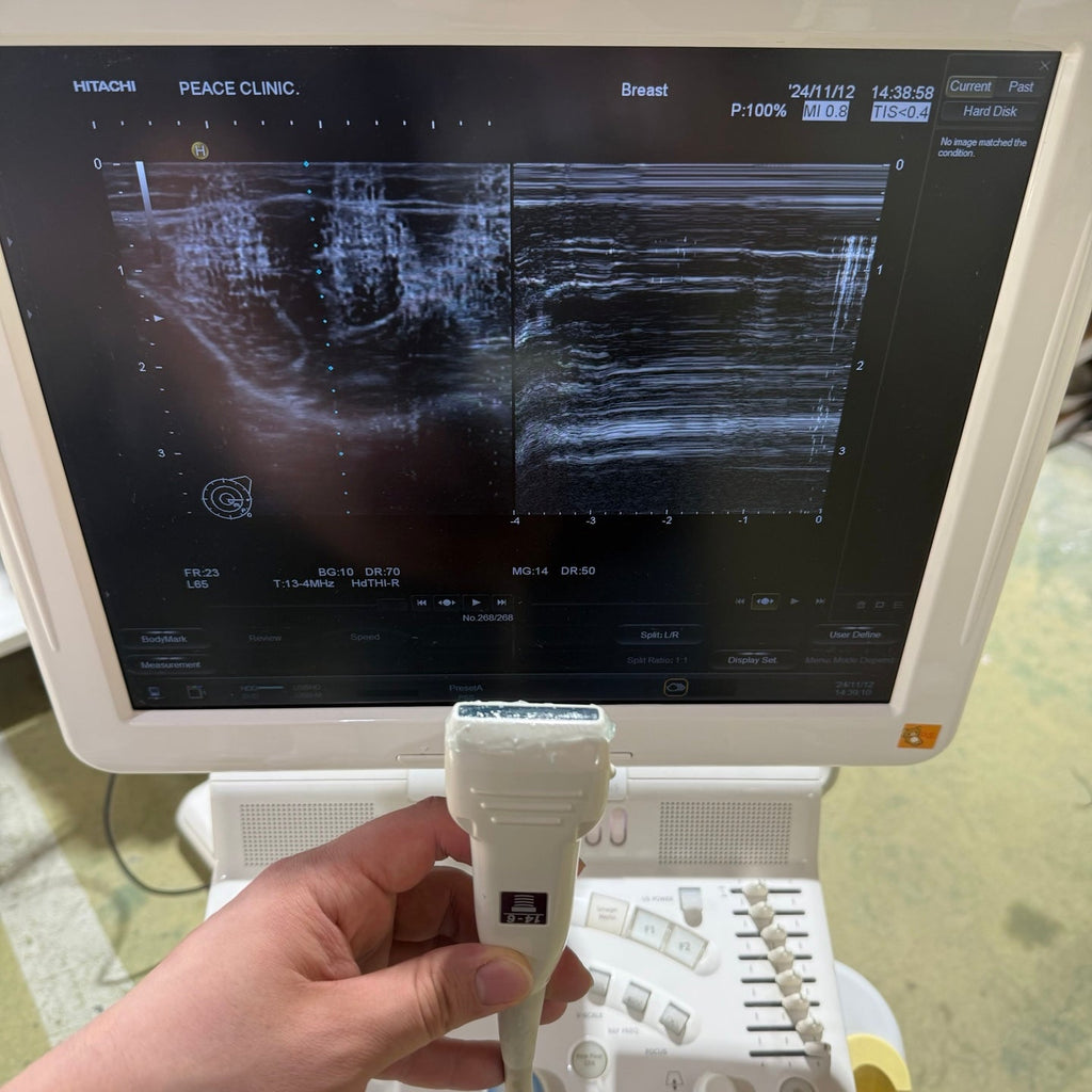 Used HITACHI Avius HI VISION Ultrasound System With 2Probes
