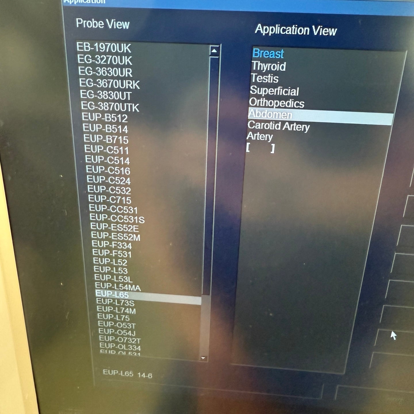 Pre-Owned HITACHI Avius HI VISION Ultrasound System With 2Probes