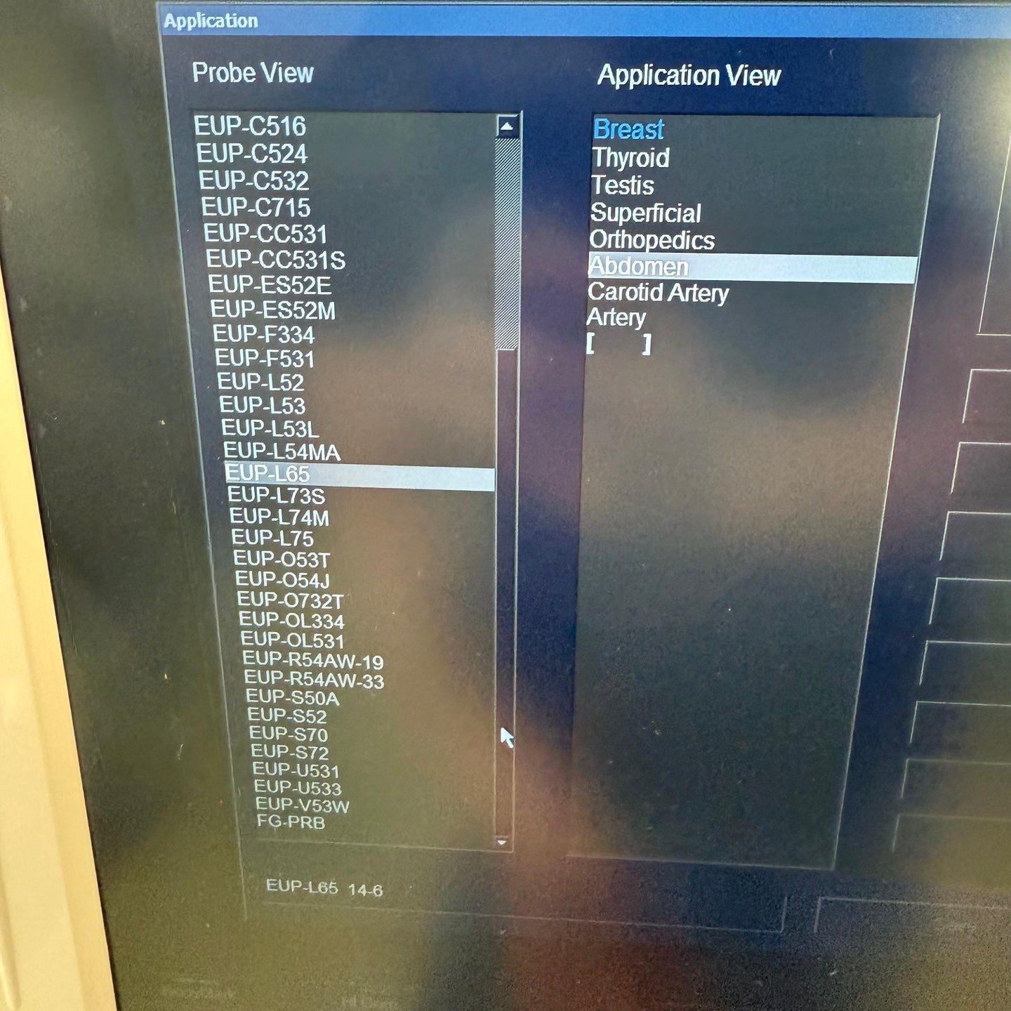 Pre-Owned HITACHI Avius HI VISION Ultrasound System With 2Probes
