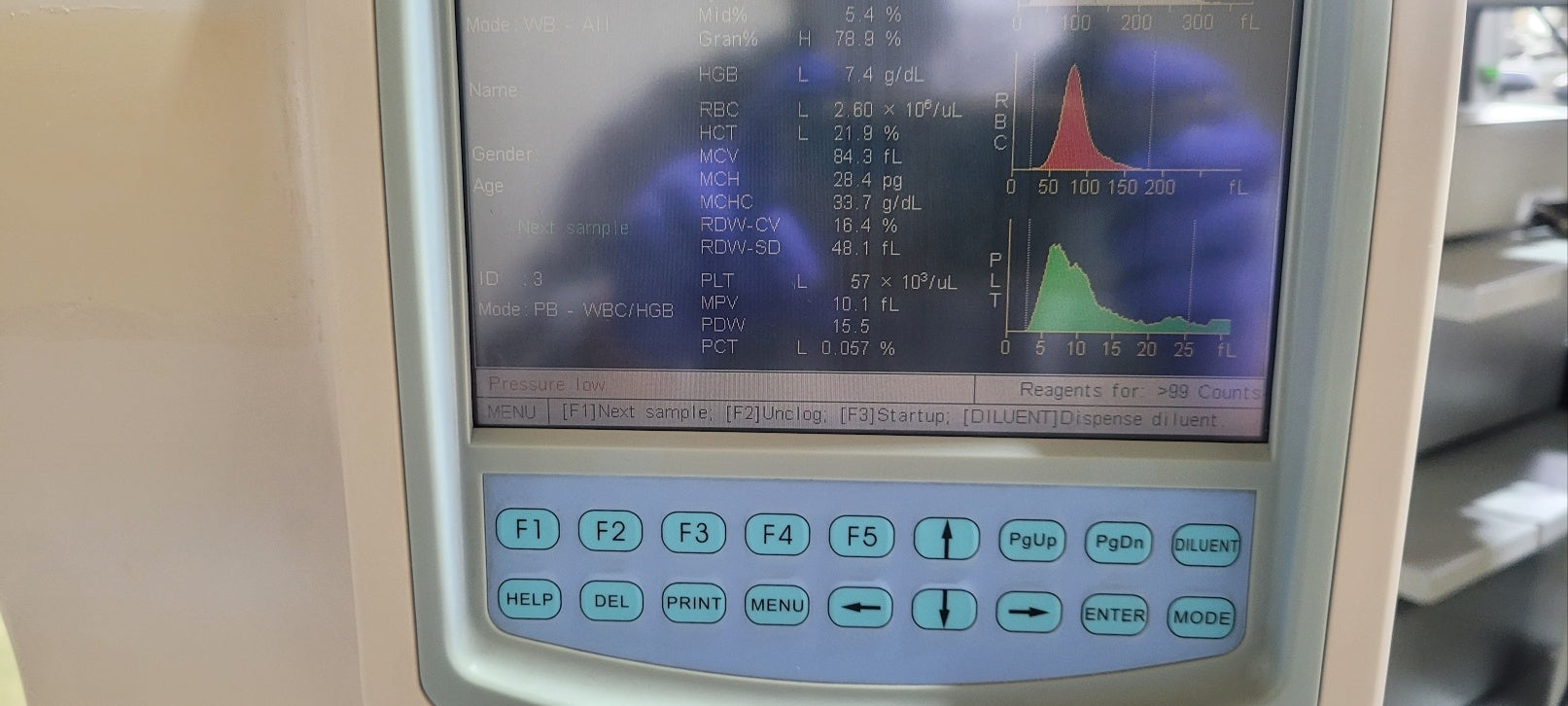 Used Mindray BC 2800 CBC