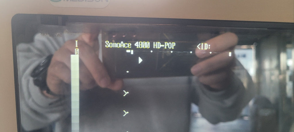 Medison Sonoace 4800HD SonorexPop With Convex Linear Ultrasound