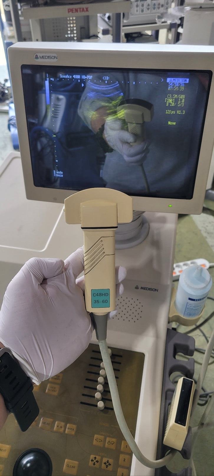 Medison Sonoace 4800HD SonorexPop With Convex Linear Ultrasound