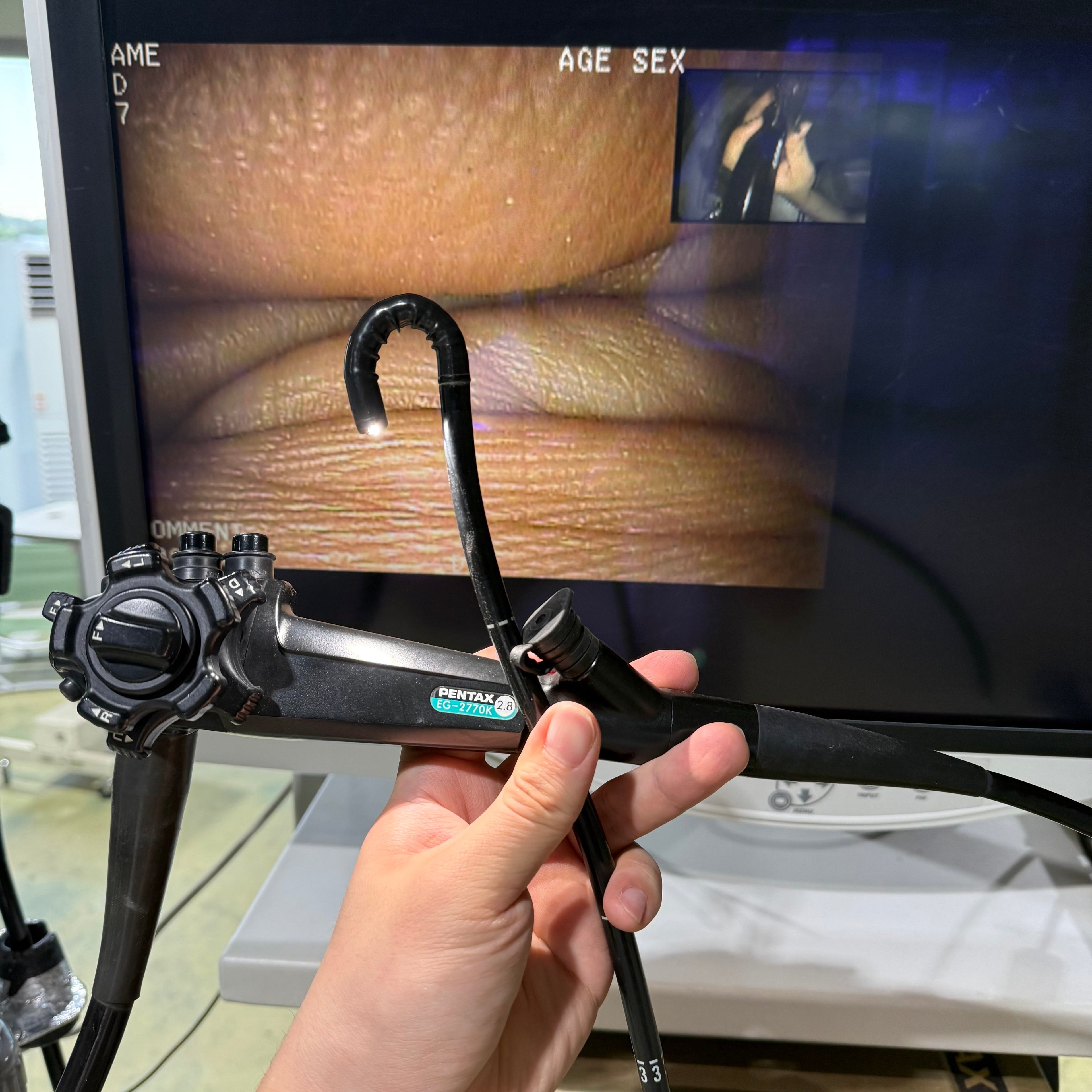 Pentax EPK-1000 with EG-2770K Gastroscope System