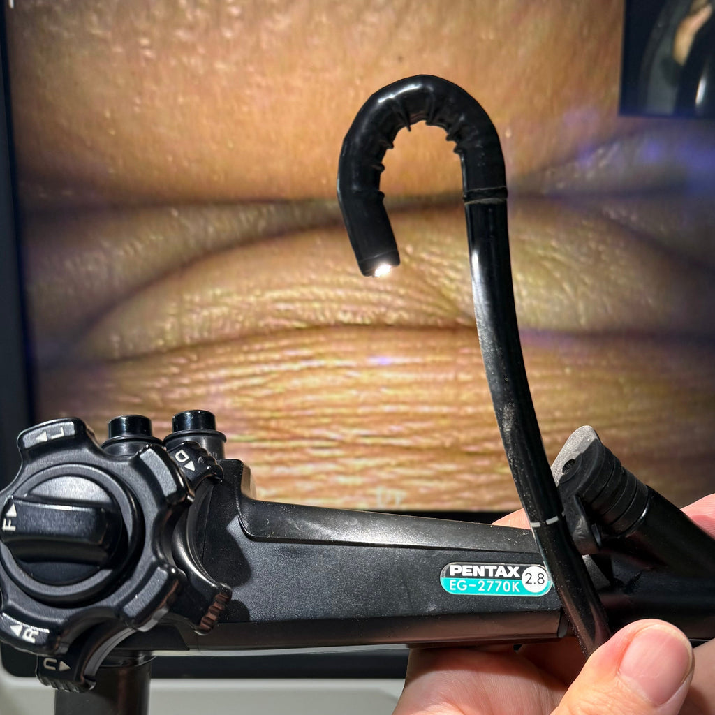 Pentax EPK-1000 with EG-2770K Gastroscope System
