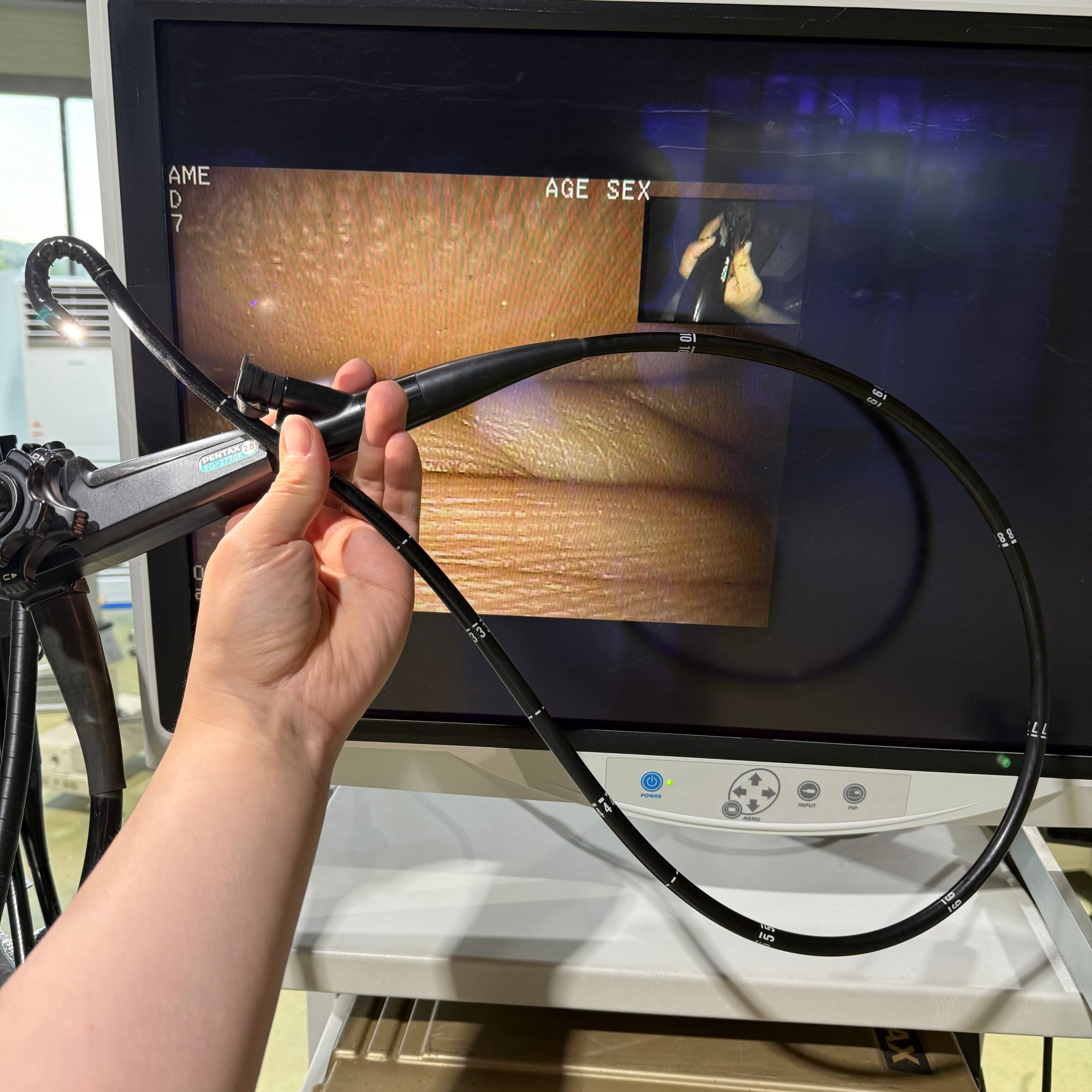 Pentax EPK-1000 with EG-2770K Gastroscope System