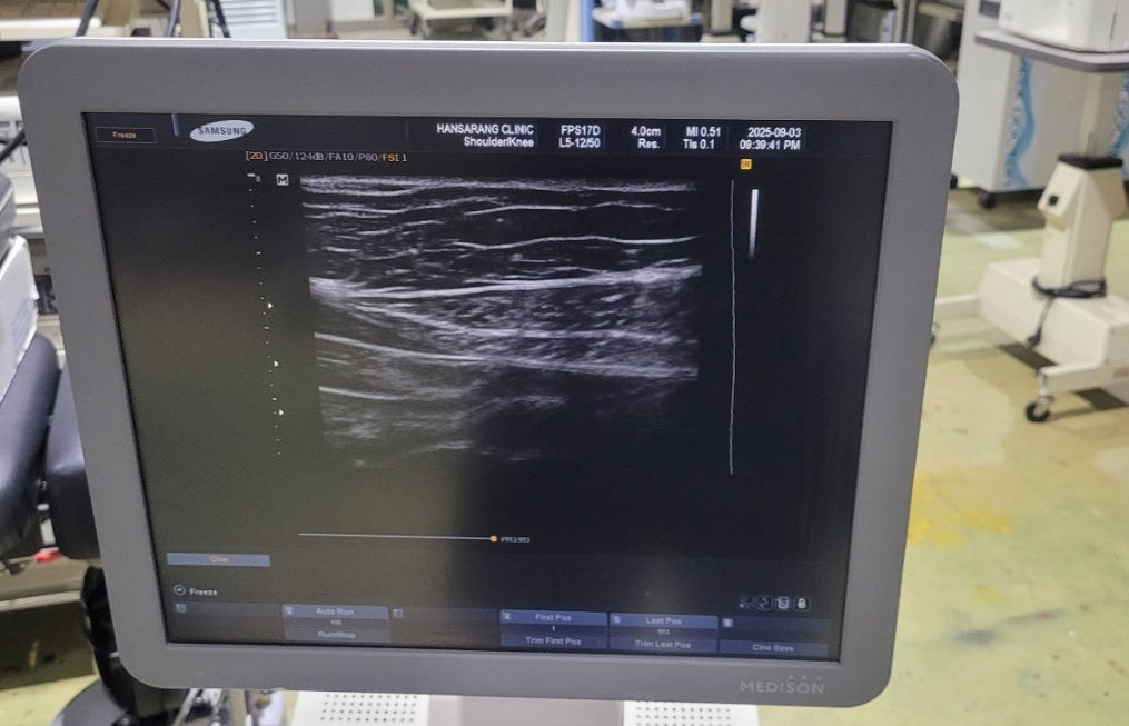 Samsung Medison Sonoace R7 With Convex and Linear