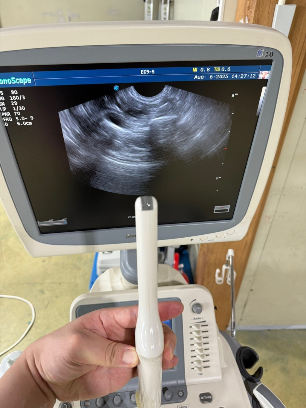Sonoscape S20 with 3 Probes Convex Linear Vaginal