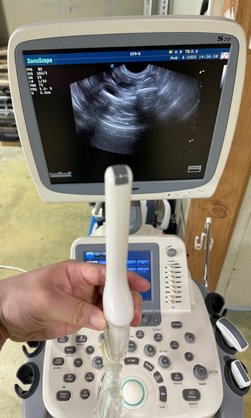 Pre-Owned Sonoscape S20 Ultrasound 3 Probes Convex Linear Vaginal