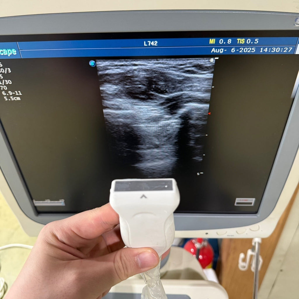 Sonoscape S20 with 3 Probes Convex Linear Vaginal