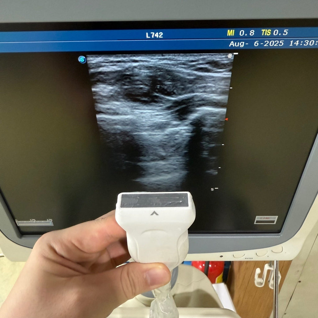 Sonoscape S20 with 3 Probes Convex Linear Vaginal