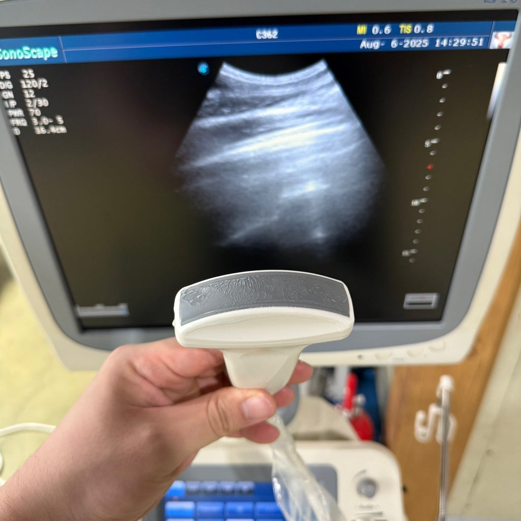Sonoscape S20 with 3 Probes Convex Linear Vaginal