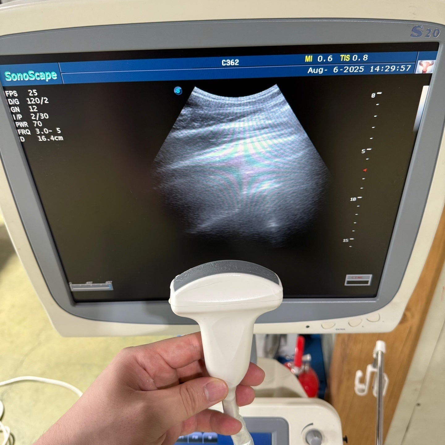 Sonoscape S20 with 3 Probes Convex Linear Vaginal