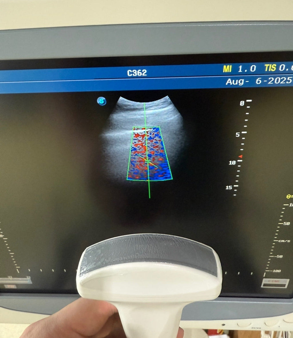 Sonoscape S20 with 3 Probes Convex Linear Vaginal