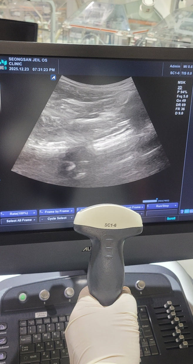 Alpinion SC1-6H Convex Probe