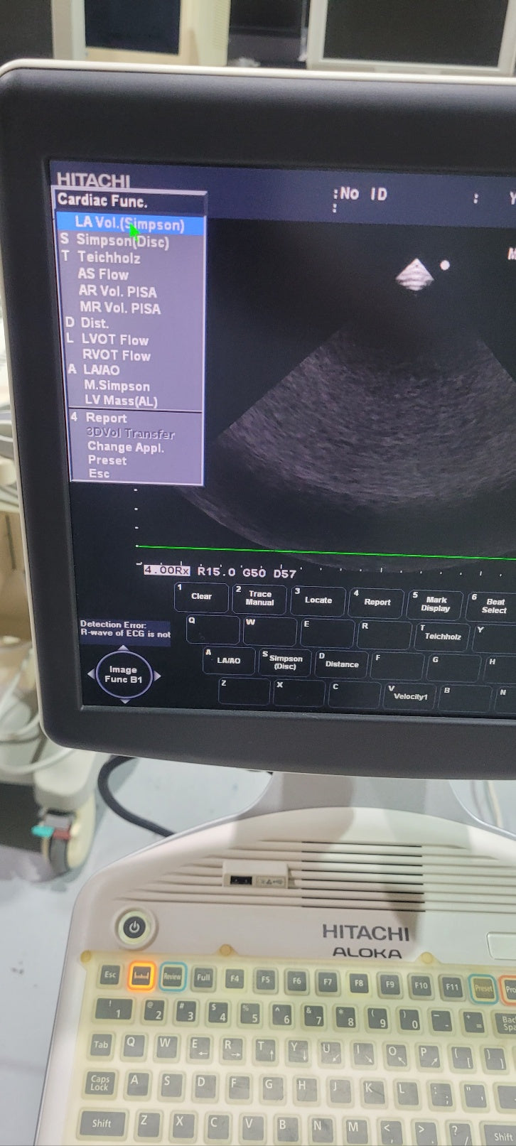 Pre-Owned Hitachi Aloka F37 with Convex Linear Cardiac UST 5299 UST 9123 UST 5413 3 Probes