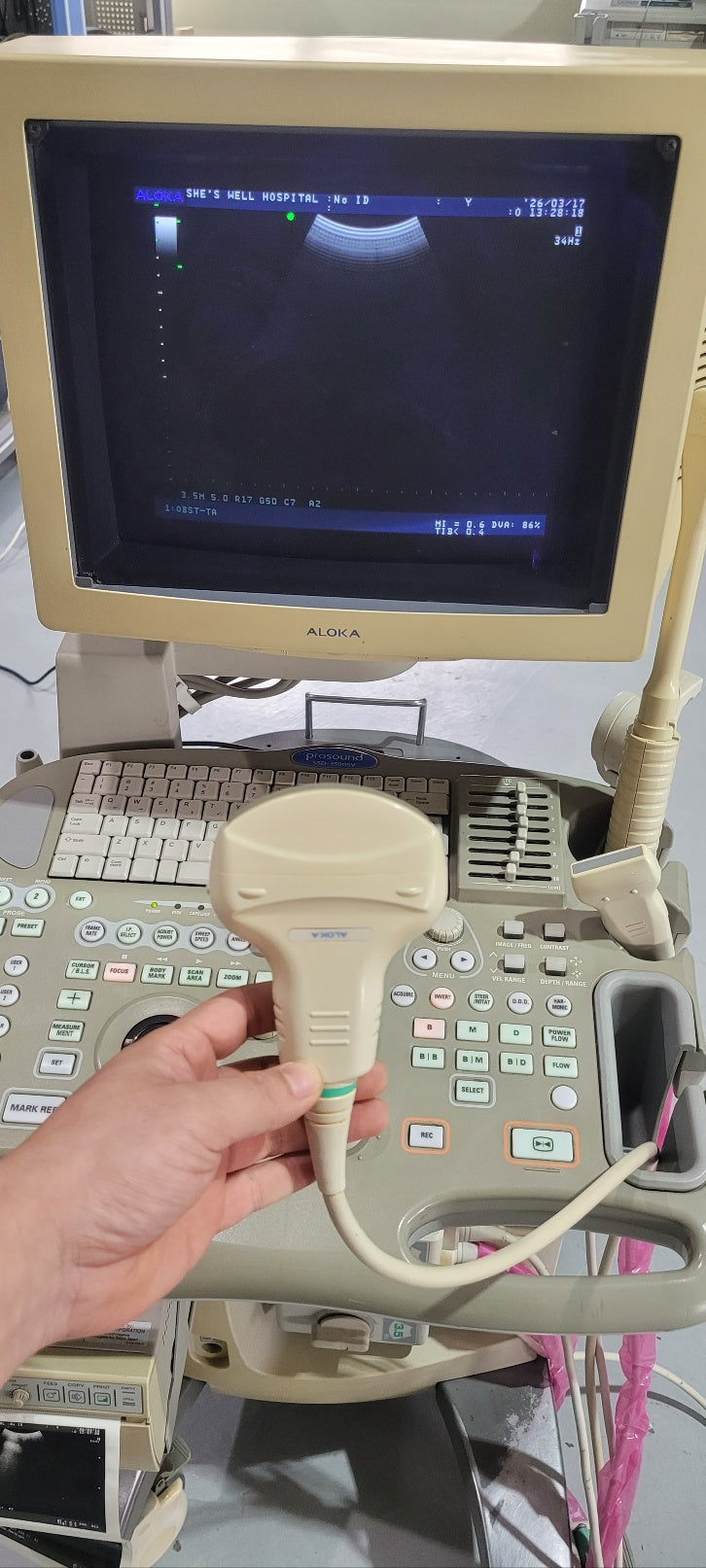 Aloka SSD-3500SV with Convex, Linear & Vaginal Probes
