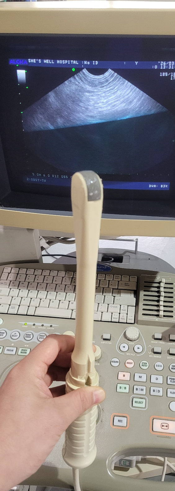 Aloka SSD-3500SV with Convex, Linear & Vaginal Probes