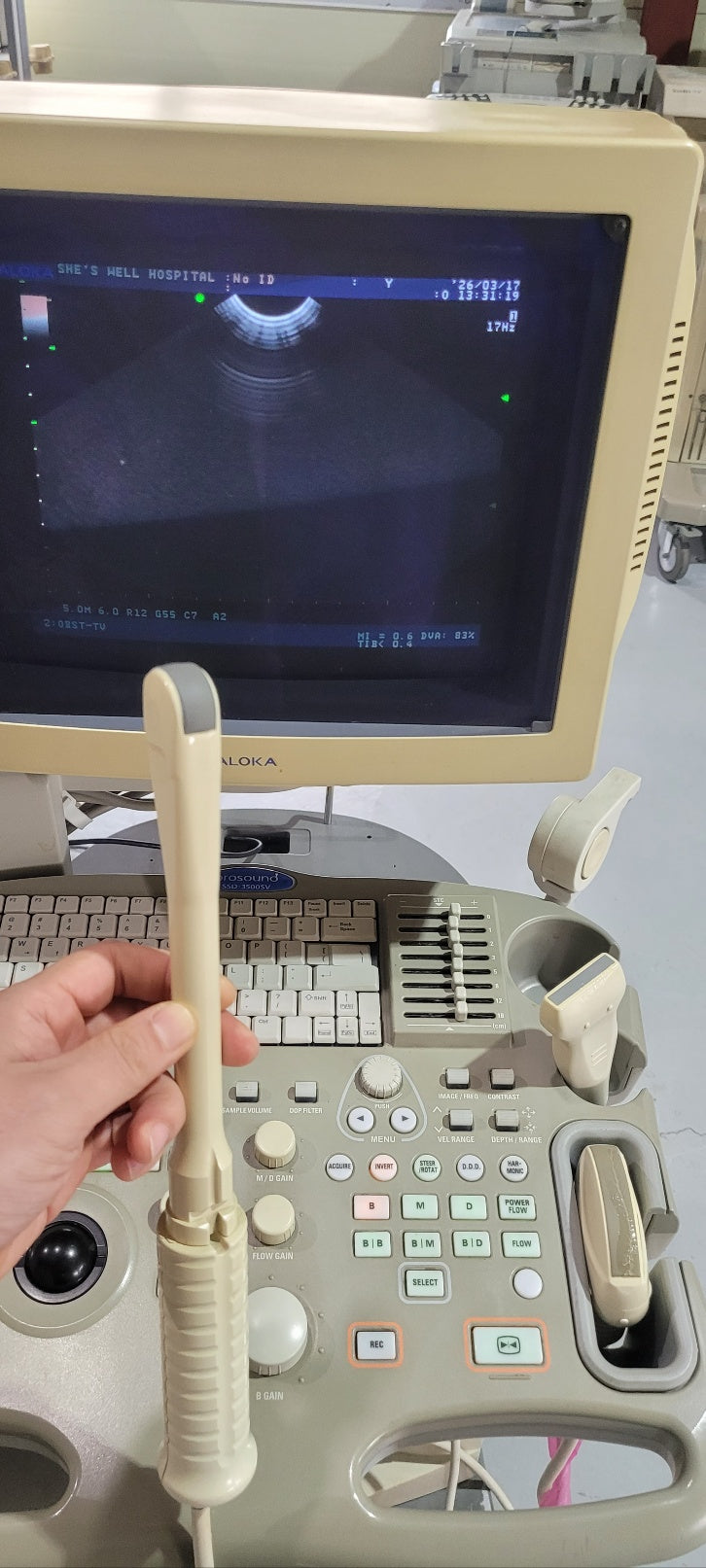 Aloka SSD-3500SV with Convex, Linear & Vaginal Probes
