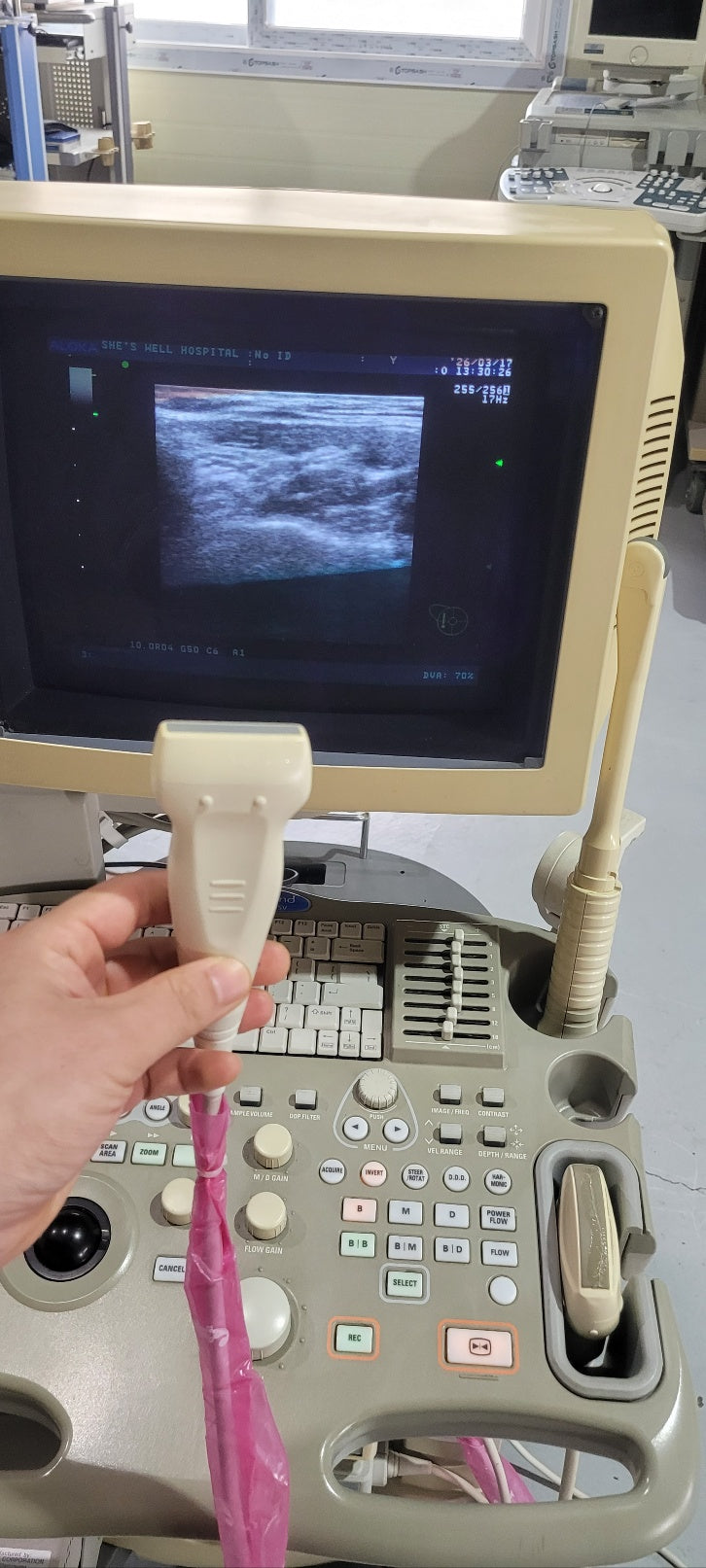 Aloka SSD-3500SV with Convex, Linear & Vaginal Probes