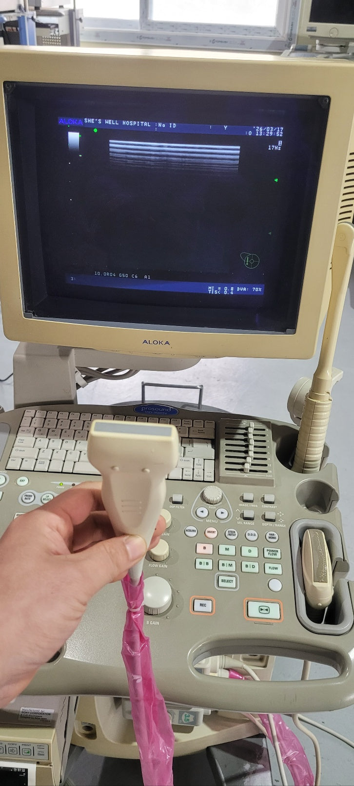 Aloka SSD-3500SV with Convex, Linear & Vaginal Probes