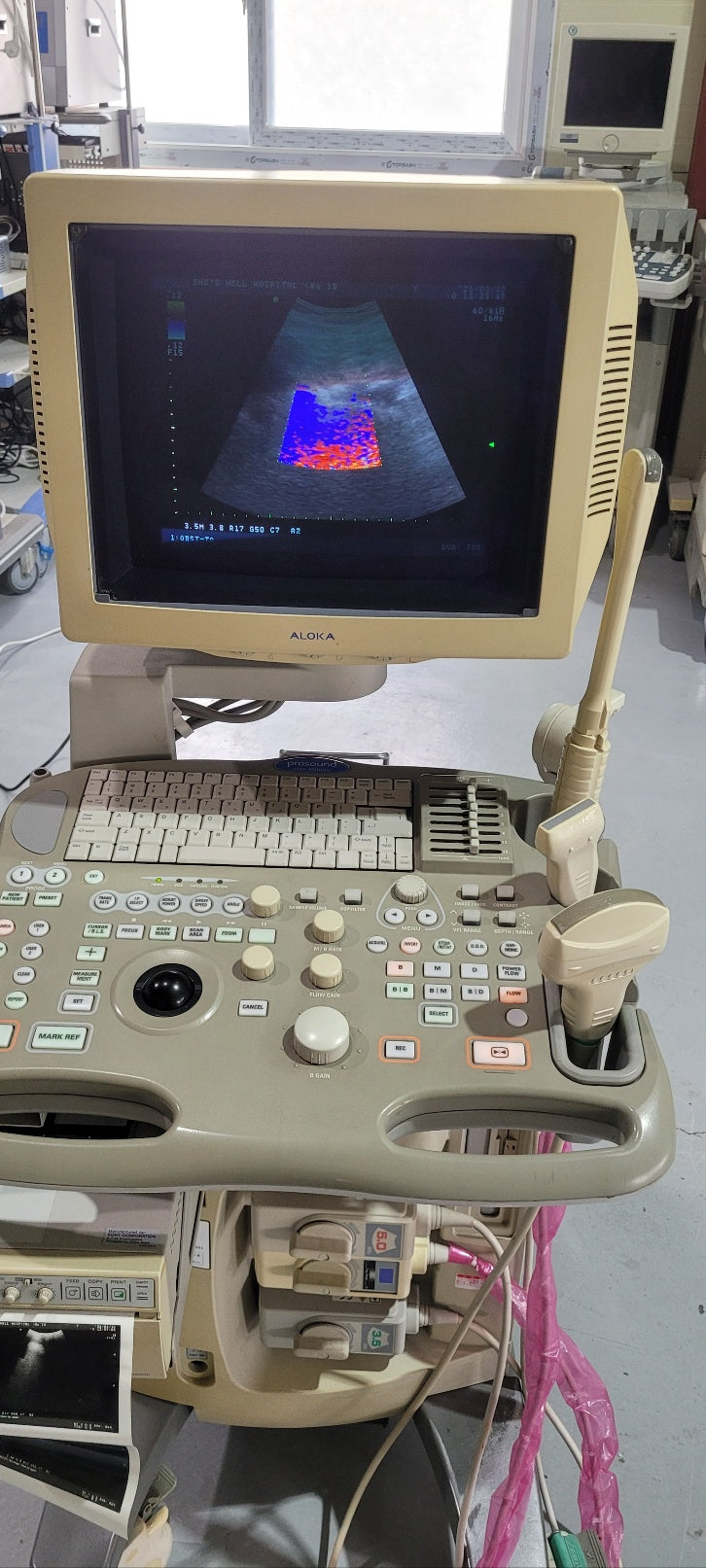Aloka SSD-3500SV with Convex, Linear & Vaginal Probes