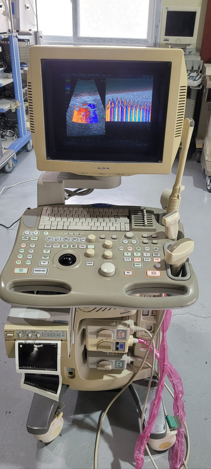 Aloka SSD-3500SV with Convex, Linear & Vaginal Probes