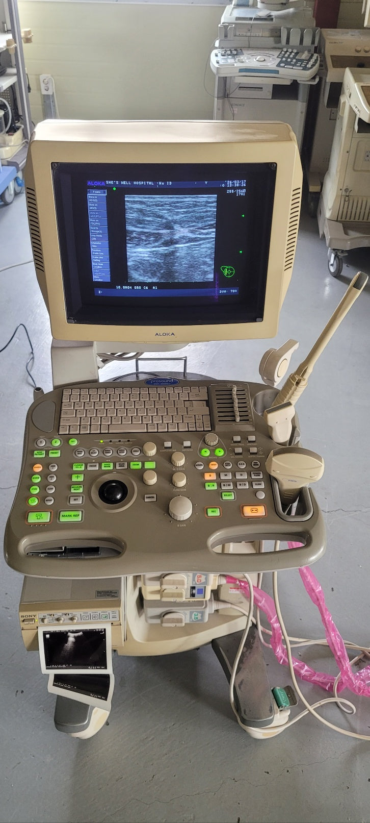Aloka SSD-3500SV with Convex, Linear & Vaginal Probes