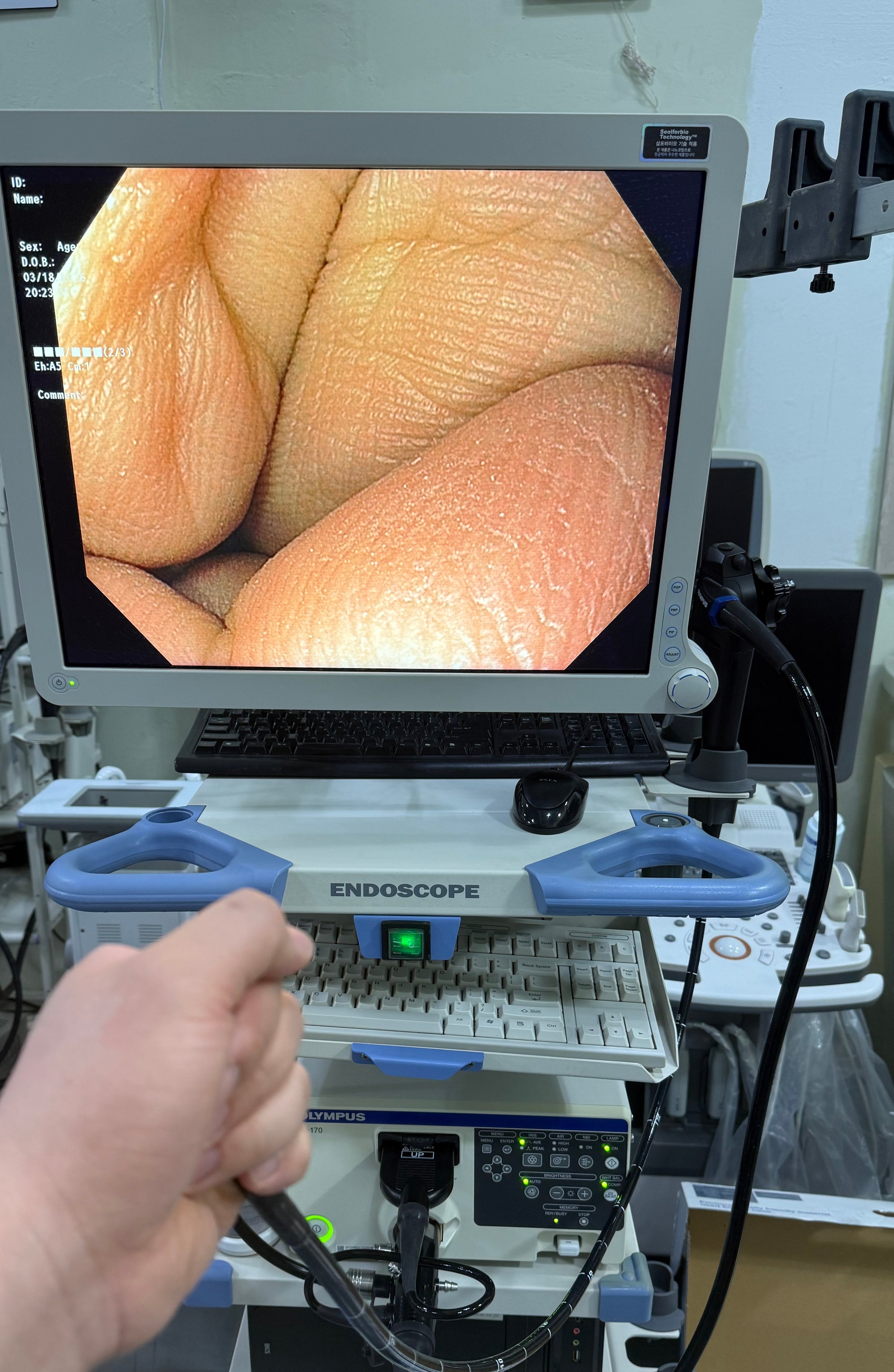 Sale For Olympus GIF H170 Gastroscope