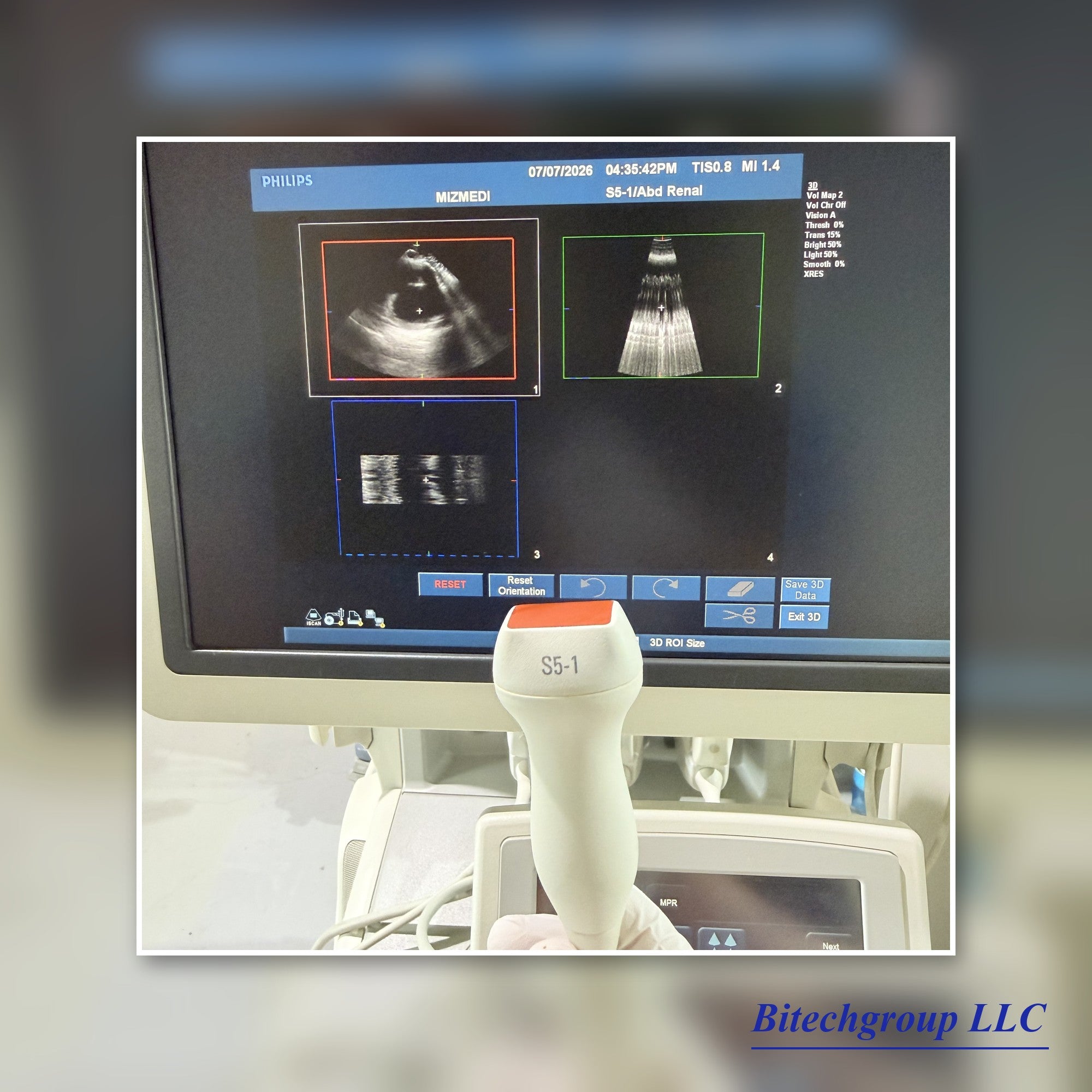 Philips IU22 with Cardiac Linear Hakistick 3 Transducer | Bitech Group