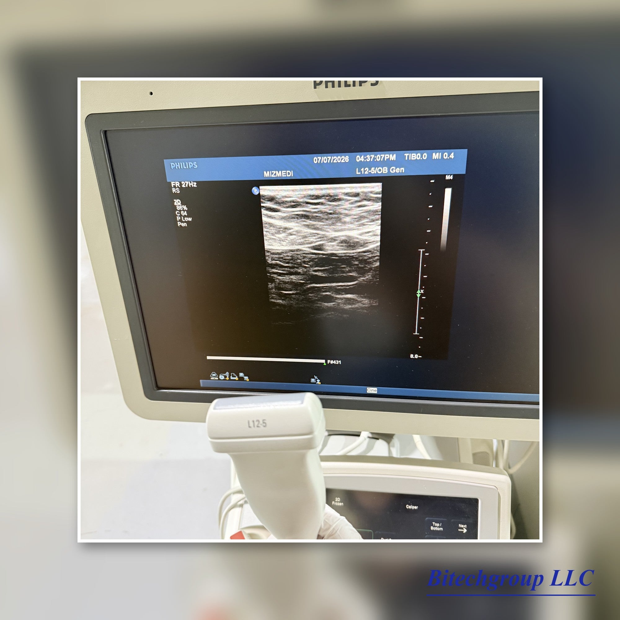Philips IU22 with Cardiac Linear Hakistick 3 Transducer | Bitech Group