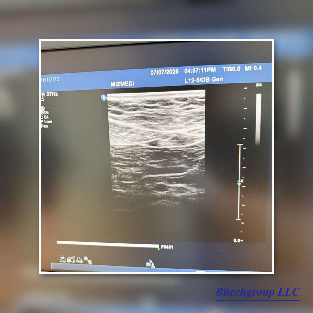Philips IU22 with Cardiac Linear Hakistick 3 Transducer | Bitech Group