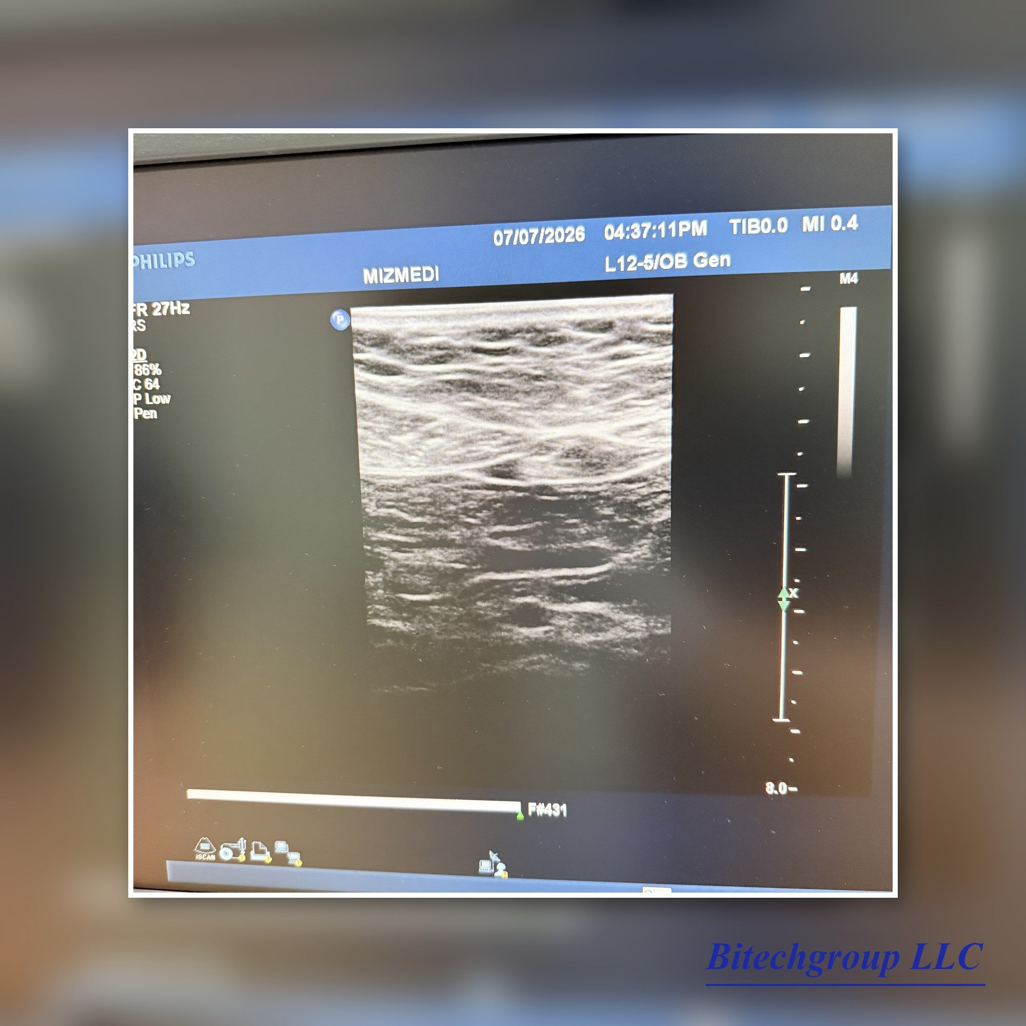 Philips IU22 with Cardiac Linear Hakistick 3 Transducer | Bitech Group