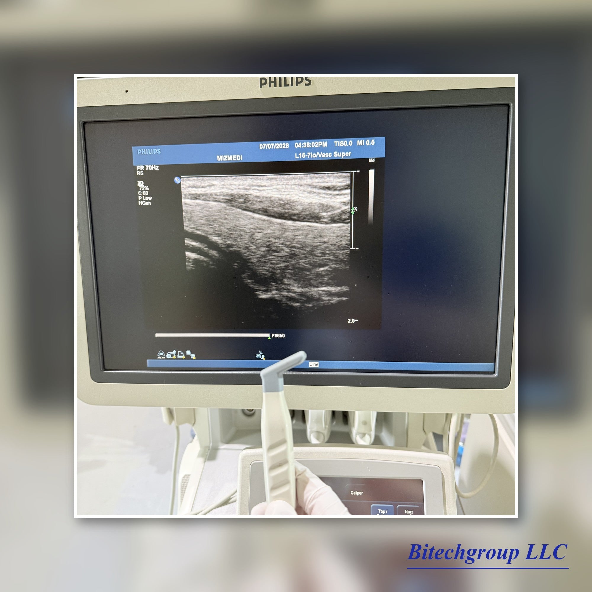 Philips IU22 with Cardiac Linear Hakistick 3 Transducer | Bitech Group