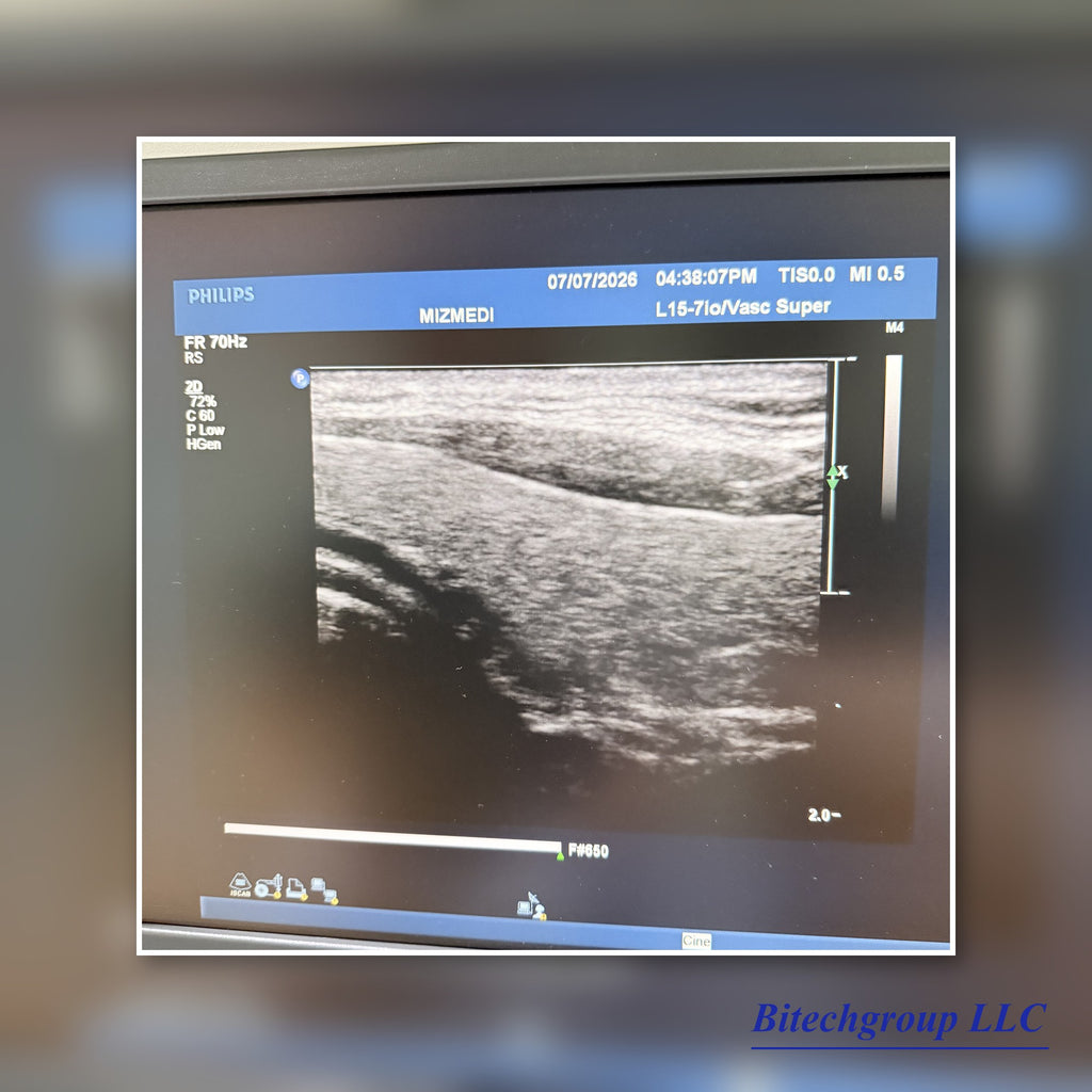 Philips IU22 with Cardiac Linear Hakistick 3 Transducer | Bitech Group